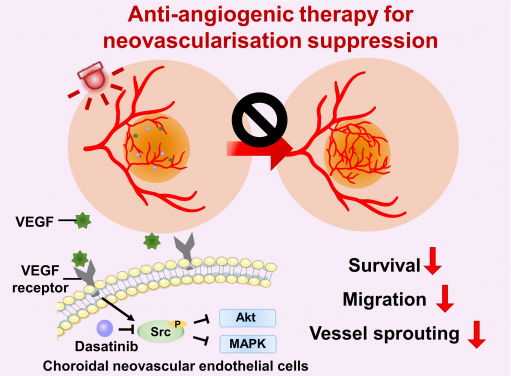 Anti-angiogenic therapy suppresses choroidal neovascularisation (CNV) by inhibiting vascular endothelial growth factor (VEGF)-related pathways. The study represents the first attempt at integrating a photoactivatable anti-angiogenic agent with a photosensitiser into a single nanoformulation for age-related macular degeneration treatment, which opens up new avenues for the development of minimally-invasive therapeutics for AMD and other neovascular ocular disorders.